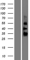 Western blot validation of overexpression lysate (Cat# LY426198) using anti-DDK antibody (Cat# TA50011-100). Left: Cell lysates from un-transfected HEK293T cells; Right: Cell lysates from HEK293T cells transfected with RC225366 using transfection reagent MegaTran 2.0 (Cat# TT210002).