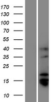 Western blot validation of overexpression lysate (Cat# LY427083) using anti-DDK antibody (Cat# TA50011-100). Left: Cell lysates from un-transfected HEK293T cells; Right: Cell lysates from HEK293T cells transfected with RC225027 using transfection reagent MegaTran 2.0 (Cat# TT210002).