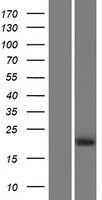 Western blot validation of overexpression lysate (Cat# LY426287) using anti-DDK antibody (Cat# TA50011-100). Left: Cell lysates from un-transfected HEK293T cells; Right: Cell lysates from HEK293T cells transfected with RC225179 using transfection reagent MegaTran 2.0 (Cat# TT210002).