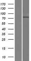 Western blot validation of overexpression lysate (Cat# LY426292) using anti-DDK antibody (Cat# TA50011-100). Left: Cell lysates from un-transfected HEK293T cells; Right: Cell lysates from HEK293T cells transfected with RC226040 using transfection reagent MegaTran 2.0 (Cat# TT210002).