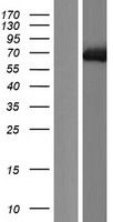 Western blot validation of overexpression lysate (Cat# LY426626) using anti-DDK antibody (Cat# TA50011-100). Left: Cell lysates from un-transfected HEK293T cells; Right: Cell lysates from HEK293T cells transfected with RC226022 using transfection reagent MegaTran 2.0 (Cat# TT210002).