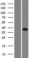 Western blot validation of overexpression lysate (Cat# LY426144) using anti-DDK antibody (Cat# TA50011-100). Left: Cell lysates from un-transfected HEK293T cells; Right: Cell lysates from HEK293T cells transfected with RC225468 using transfection reagent MegaTran 2.0 (Cat# TT210002).