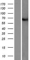 Western blot validation of overexpression lysate (Cat# LY430400) using anti-DDK antibody (Cat# TA50011-100). Left: Cell lysates from un-transfected HEK293T cells; Right: Cell lysates from HEK293T cells transfected with RC225981 using transfection reagent MegaTran 2.0 (Cat# TT210002).