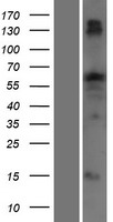 Western blot validation of overexpression lysate (Cat# LY426454) using anti-DDK antibody (Cat# TA50011-100). Left: Cell lysates from un-transfected HEK293T cells; Right: Cell lysates from HEK293T cells transfected with RC225966 using transfection reagent MegaTran 2.0 (Cat# TT210002).