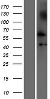 Western blot validation of overexpression lysate (Cat# LY426925) using anti-DDK antibody (Cat# TA50011-100). Left: Cell lysates from un-transfected HEK293T cells; Right: Cell lysates from HEK293T cells transfected with RC225950 using transfection reagent MegaTran 2.0 (Cat# TT210002).