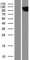 Western blot validation of overexpression lysate (Cat# LY426901) using anti-DDK antibody (Cat# TA50011-100). Left: Cell lysates from un-transfected HEK293T cells; Right: Cell lysates from HEK293T cells transfected with RC226200 using transfection reagent MegaTran 2.0 (Cat# TT210002).