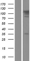 Western blot validation of overexpression lysate (Cat# LY430114) using anti-DDK antibody (Cat# TA50011-100). Left: Cell lysates from un-transfected HEK293T cells; Right: Cell lysates from HEK293T cells transfected with RC226280 using transfection reagent MegaTran 2.0 (Cat# TT210002).