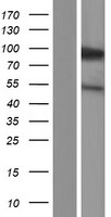 Western blot validation of overexpression lysate (Cat# LY427162) using anti-DDK antibody (Cat# TA50011-100). Left: Cell lysates from un-transfected HEK293T cells; Right: Cell lysates from HEK293T cells transfected with RC226196 using transfection reagent MegaTran 2.0 (Cat# TT210002).