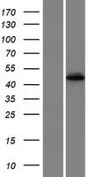 Western blot validation of overexpression lysate (Cat# LY426429) using anti-DDK antibody (Cat# TA50011-100). Left: Cell lysates from un-transfected HEK293T cells; Right: Cell lysates from HEK293T cells transfected with RC225637 using transfection reagent MegaTran 2.0 (Cat# TT210002).