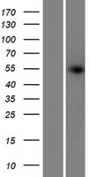 Western blot validation of overexpression lysate (Cat# LY425457) using anti-DDK antibody (Cat# TA50011-100). Left: Cell lysates from un-transfected HEK293T cells; Right: Cell lysates from HEK293T cells transfected with RC225804 using transfection reagent MegaTran 2.0 (Cat# TT210002).