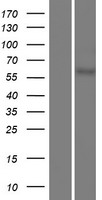 Western blot validation of overexpression lysate (Cat# LY426293) using anti-DDK antibody (Cat# TA50011-100). Left: Cell lysates from un-transfected HEK293T cells; Right: Cell lysates from HEK293T cells transfected with RC225907 using transfection reagent MegaTran 2.0 (Cat# TT210002).