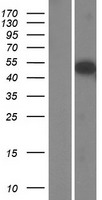 Western blot validation of overexpression lysate (Cat# LY426158) using anti-DDK antibody (Cat# TA50011-100). Left: Cell lysates from un-transfected HEK293T cells; Right: Cell lysates from HEK293T cells transfected with RC225742 using transfection reagent MegaTran 2.0 (Cat# TT210002).