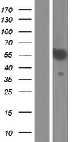 Western blot validation of overexpression lysate (Cat# LY427404) using anti-DDK antibody (Cat# TA50011-100). Left: Cell lysates from un-transfected HEK293T cells; Right: Cell lysates from HEK293T cells transfected with RC225722 using transfection reagent MegaTran 2.0 (Cat# TT210002).