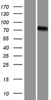 Western blot validation of overexpression lysate (Cat# LY432343) using anti-DDK antibody (Cat# TA50011-100). Left: Cell lysates from un-transfected HEK293T cells; Right: Cell lysates from HEK293T cells transfected with RC229328 using transfection reagent MegaTran 2.0 (Cat# TT210002).