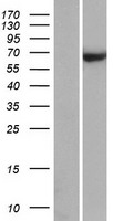 Western blot validation of overexpression lysate (Cat# LY432327) using anti-DDK antibody (Cat# TA50011-100). Left: Cell lysates from un-transfected HEK293T cells; Right: Cell lysates from HEK293T cells transfected with RC229310 using transfection reagent MegaTran 2.0 (Cat# TT210002).