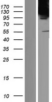 Western blot validation of overexpression lysate (Cat# LY431684) using anti-DDK antibody (Cat# TA50011-100). Left: Cell lysates from un-transfected HEK293T cells; Right: Cell lysates from HEK293T cells transfected with RC228656 using transfection reagent MegaTran 2.0 (Cat# TT210002).