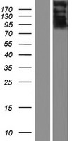 Western blot validation of overexpression lysate (Cat# LY431657) using anti-DDK antibody (Cat# TA50011-100). Left: Cell lysates from un-transfected HEK293T cells; Right: Cell lysates from HEK293T cells transfected with RC228629 using transfection reagent MegaTran 2.0 (Cat# TT210002).