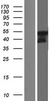 Western blot validation of overexpression lysate (Cat# LY428674) using anti-DDK antibody (Cat# TA50011-100). Left: Cell lysates from un-transfected HEK293T cells; Right: Cell lysates from HEK293T cells transfected with RC227391 using transfection reagent MegaTran 2.0 (Cat# TT210002).
