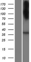 Western blot validation of overexpression lysate (Cat# LY432301) using anti-DDK antibody (Cat# TA50011-100). Left: Cell lysates from un-transfected HEK293T cells; Right: Cell lysates from HEK293T cells transfected with RC229283 using transfection reagent MegaTran 2.0 (Cat# TT210002).