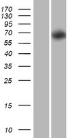 Western blot validation of overexpression lysate (Cat# LY432300) using anti-DDK antibody (Cat# TA50011-100). Left: Cell lysates from un-transfected HEK293T cells; Right: Cell lysates from HEK293T cells transfected with RC229282 using transfection reagent MegaTran 2.0 (Cat# TT210002).