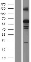 Western blot validation of overexpression lysate (Cat# LY432267) using anti-DDK antibody (Cat# TA50011-100). Left: Cell lysates from un-transfected HEK293T cells; Right: Cell lysates from HEK293T cells transfected with RC229247 using transfection reagent MegaTran 2.0 (Cat# TT210002).