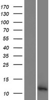 Western blot validation of overexpression lysate (Cat# LY432117) using anti-DDK antibody (Cat# TA50011-100). Left: Cell lysates from un-transfected HEK293T cells; Right: Cell lysates from HEK293T cells transfected with RC229091 using transfection reagent MegaTran 2.0 (Cat# TT210002).