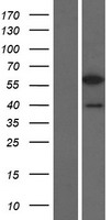 Western blot validation of overexpression lysate (Cat# LY432200) using anti-DDK antibody (Cat# TA50011-100). Left: Cell lysates from un-transfected HEK293T cells; Right: Cell lysates from HEK293T cells transfected with RC229176 using transfection reagent MegaTran 2.0 (Cat# TT210002).