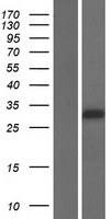 Western blot validation of overexpression lysate (Cat# LY432181) using anti-DDK antibody (Cat# TA50011-100). Left: Cell lysates from un-transfected HEK293T cells; Right: Cell lysates from HEK293T cells transfected with RC229157 using transfection reagent MegaTran 2.0 (Cat# TT210002).