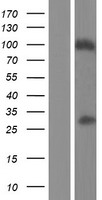 Western blot validation of overexpression lysate (Cat# LY433553) using anti-DDK antibody (Cat# TA50011-100). Left: Cell lysates from un-transfected HEK293T cells; Right: Cell lysates from HEK293T cells transfected with RC230553 using transfection reagent MegaTran 2.0 (Cat# TT210002).