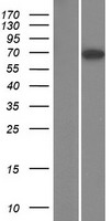 Western blot validation of overexpression lysate (Cat# LY433352) using anti-DDK antibody (Cat# TA50011-100). Left: Cell lysates from un-transfected HEK293T cells; Right: Cell lysates from HEK293T cells transfected with RC230352 using transfection reagent MegaTran 2.0 (Cat# TT210002).