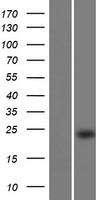 Western blot validation of overexpression lysate (Cat# LY432671) using anti-DDK antibody (Cat# TA50011-100). Left: Cell lysates from un-transfected HEK293T cells; Right: Cell lysates from HEK293T cells transfected with RC229671 using transfection reagent MegaTran 2.0 (Cat# TT210002).