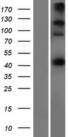 Western blot validation of overexpression lysate (Cat# LY428817) using anti-DDK antibody (Cat# TA50011-100). Left: Cell lysates from un-transfected HEK293T cells; Right: Cell lysates from HEK293T cells transfected with RC227906 using transfection reagent MegaTran 2.0 (Cat# TT210002).