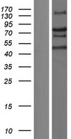 Western blot validation of overexpression lysate (Cat# LY429439) using anti-DDK antibody (Cat# TA50011-100). Left: Cell lysates from un-transfected HEK293T cells; Right: Cell lysates from HEK293T cells transfected with RC227892 using transfection reagent MegaTran 2.0 (Cat# TT210002).