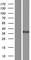 Western blot validation of overexpression lysate (Cat# LY428671) using anti-DDK antibody (Cat# TA50011-100). Left: Cell lysates from un-transfected HEK293T cells; Right: Cell lysates from HEK293T cells transfected with RC227843 using transfection reagent MegaTran 2.0 (Cat# TT210002).