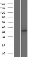 Western blot validation of overexpression lysate (Cat# LY427947) using anti-DDK antibody (Cat# TA50011-100). Left: Cell lysates from un-transfected HEK293T cells; Right: Cell lysates from HEK293T cells transfected with RC227831 using transfection reagent MegaTran 2.0 (Cat# TT210002).