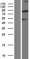 Western blot validation of overexpression lysate (Cat# LY428447) using anti-DDK antibody (Cat# TA50011-100). Left: Cell lysates from un-transfected HEK293T cells; Right: Cell lysates from HEK293T cells transfected with RC227826 using transfection reagent MegaTran 2.0 (Cat# TT210002).