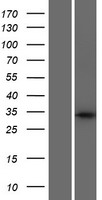 Western blot validation of overexpression lysate (Cat# LY425285) using anti-DDK antibody (Cat# TA50011-100). Left: Cell lysates from un-transfected HEK293T cells; Right: Cell lysates from HEK293T cells transfected with RC227819 using transfection reagent MegaTran 2.0 (Cat# TT210002).