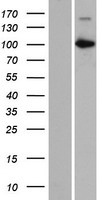 Western blot validation of overexpression lysate (Cat# LY431650) using anti-DDK antibody (Cat# TA50011-100). Left: Cell lysates from un-transfected HEK293T cells; Right: Cell lysates from HEK293T cells transfected with RC228622 using transfection reagent MegaTran 2.0 (Cat# TT210002).