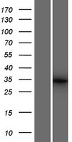 Western blot validation of overexpression lysate (Cat# LY427913) using anti-DDK antibody (Cat# TA50011-100). Left: Cell lysates from un-transfected HEK293T cells; Right: Cell lysates from HEK293T cells transfected with RC227969 using transfection reagent MegaTran 2.0 (Cat# TT210002).