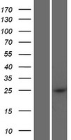 Western blot validation of overexpression lysate (Cat# LY428621) using anti-DDK antibody (Cat# TA50011-100). Left: Cell lysates from un-transfected HEK293T cells; Right: Cell lysates from HEK293T cells transfected with RC227796 using transfection reagent MegaTran 2.0 (Cat# TT210002).