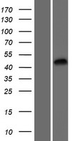 Western blot validation of overexpression lysate (Cat# LY428438) using anti-DDK antibody (Cat# TA50011-100). Left: Cell lysates from un-transfected HEK293T cells; Right: Cell lysates from HEK293T cells transfected with RC227436 using transfection reagent MegaTran 2.0 (Cat# TT210002).