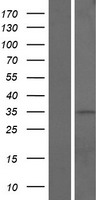 Western blot validation of overexpression lysate (Cat# LY428534) using anti-DDK antibody (Cat# TA50011-100). Left: Cell lysates from un-transfected HEK293T cells; Right: Cell lysates from HEK293T cells transfected with RC227433 using transfection reagent MegaTran 2.0 (Cat# TT210002).
