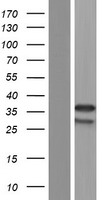 Western blot validation of overexpression lysate (Cat# LY428643) using anti-DDK antibody (Cat# TA50011-100). Left: Cell lysates from un-transfected HEK293T cells; Right: Cell lysates from HEK293T cells transfected with RC227429 using transfection reagent MegaTran 2.0 (Cat# TT210002).