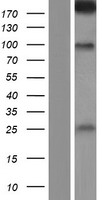 Western blot validation of overexpression lysate (Cat# LY428601) using anti-DDK antibody (Cat# TA50011-100). Left: Cell lysates from un-transfected HEK293T cells; Right: Cell lysates from HEK293T cells transfected with RC227752 using transfection reagent MegaTran 2.0 (Cat# TT210002).
