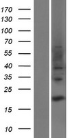 Western blot validation of overexpression lysate (Cat# LY427960) using anti-DDK antibody (Cat# TA50011-100). Left: Cell lysates from un-transfected HEK293T cells; Right: Cell lysates from HEK293T cells transfected with RC227688 using transfection reagent MegaTran 2.0 (Cat# TT210002).