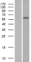 Western blot validation of overexpression lysate (Cat# LY428660) using anti-DDK antibody (Cat# TA50011-100). Left: Cell lysates from un-transfected HEK293T cells; Right: Cell lysates from HEK293T cells transfected with RC227625 using transfection reagent MegaTran 2.0 (Cat# TT210002).