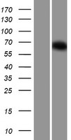 Western blot validation of overexpression lysate (Cat# LY431490) using anti-DDK antibody (Cat# TA50011-100). Left: Cell lysates from un-transfected HEK293T cells; Right: Cell lysates from HEK293T cells transfected with RC228462 using transfection reagent MegaTran 2.0 (Cat# TT210002).