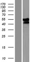 Western blot validation of overexpression lysate (Cat# LY431414) using anti-DDK antibody (Cat# TA50011-100). Left: Cell lysates from un-transfected HEK293T cells; Right: Cell lysates from HEK293T cells transfected with RC228386 using transfection reagent MegaTran 2.0 (Cat# TT210002).