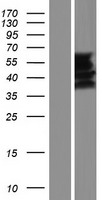 Western blot validation of overexpression lysate (Cat# LY431413) using anti-DDK antibody (Cat# TA50011-100). Left: Cell lysates from un-transfected HEK293T cells; Right: Cell lysates from HEK293T cells transfected with RC228385 using transfection reagent MegaTran 2.0 (Cat# TT210002).