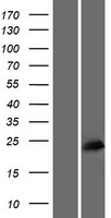 Western blot validation of overexpression lysate (Cat# LY431172) using anti-DDK antibody (Cat# TA50011-100). Left: Cell lysates from un-transfected HEK293T cells; Right: Cell lysates from HEK293T cells transfected with RC228144 using transfection reagent MegaTran 2.0 (Cat# TT210002).